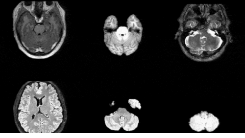 Synthetic Medical Images Are NVIDIA’s Most Practical Open Model Play This Week